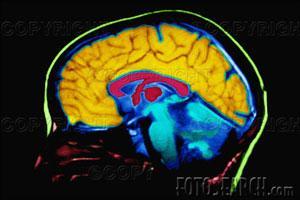 Neurobiology of Addiction and