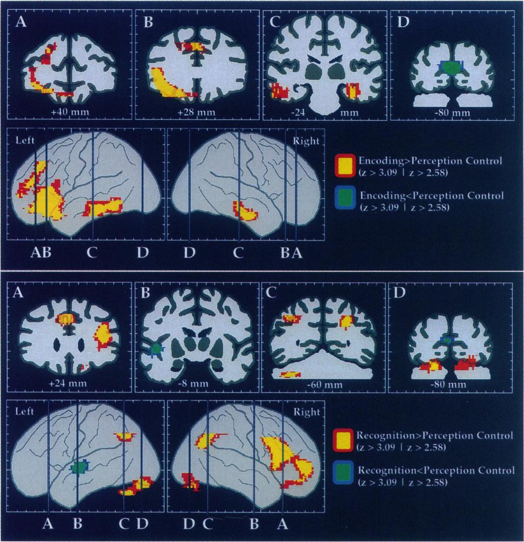 924 Neurobiology: Haxby et al Proc. Natl. Acad. Sci. USA 93 (1996) FIG. 2.
