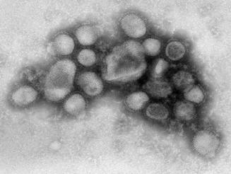 influenza type A (H1N1) virus) was first isolated from a pig in 1930.