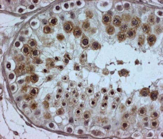 Vasa stains Pachytene Spermatocytes and Round Spermatids