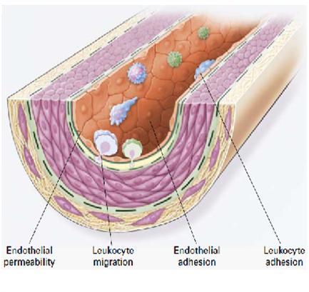 Figure 3: Atherosclerosis initiation (image from R. Ross [6]).