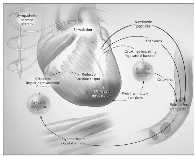 Dyspnea Differential Diagnosis: Pulmonary disease Anemia Obesity Deconditioning Psychogenic/anxiety attack BNP A vasoactive peptide that is released by myocardial stress.