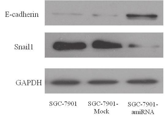 After cultured for 48h, we found that the transfection efficiency of these vectors into SGC-7901 cells were over