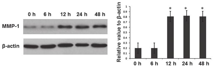05 compared with the value at 0 h. MMP 1, matrix metalloproteinase 1. A B Figure 3. MMP 10 protein expression following Helicobacter pylori infection in MGC 803 gastric cancer cells.