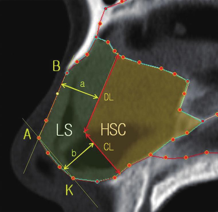 Vol. 41 / No. 2 / March 2014 Fig. 2. Measurement of the nasal septum Measurement of the area of each component using Digimizer software.