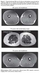 Muscle Aging From 20 to 80 years old- 30% reduction in muscle mass Decline in muscle fiber size and number Decline in muscle building process as we get older Muscle cells also seem to get fattier