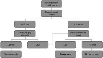 Screening for Sarcopenia In clinical settings it is appropriate to use less complex measures of physical findings Decreased handgrip strength or Difficulty arising from a chair or Difficulty walking