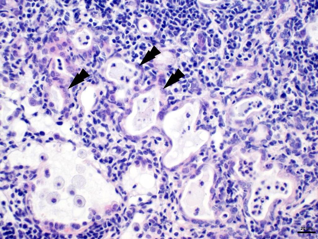 IAV mono-infected or PBS treated mice at day 7, 14 or 21 post IAV infection analyzed