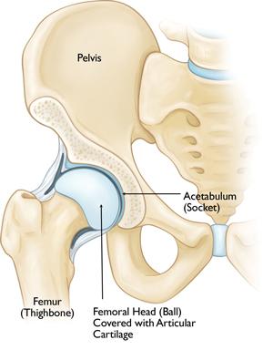 The anatomy of the hip. Description Osteoarthritis is a degenerative type of arthritis that occurs most often in people 50 years of age and older, though it may occur in younger people, too.