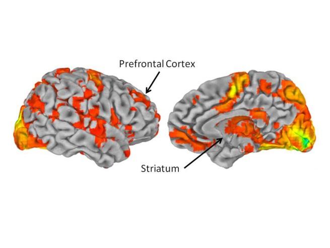 the ventral striatum, is often called the reward center of the brain. The region can drive us to repeat behaviors that provide a reward, such as money and treats.