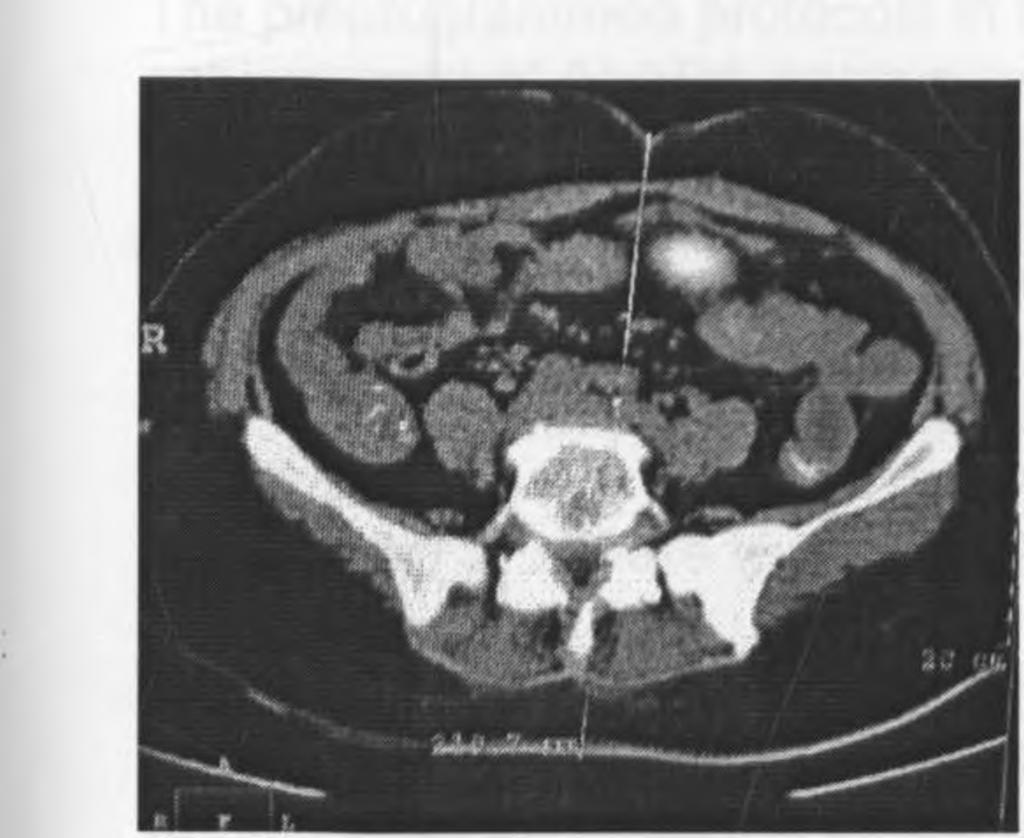 The abdominal girth did not reveal any significant correlation with the radiation dose received by the patient (Fig. 12 under results section).