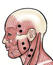 1 2 Frontalis (FRL) Temporalis Anterior (TA) midpoint b/t the eyebrow & the hairline (vertically or horizontally).