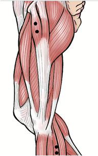 Abdominal Oblique (ABO) Internal Oblique (IO) lateral to the rectus abdominus, directly above the ASIS, 1/2 way b/t the crest & the ribs at a slightly oblique angle, The electrodes are positioned