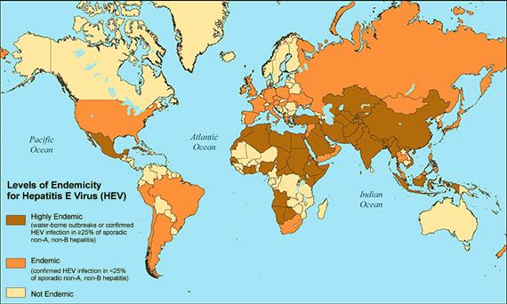 infection can result in acute hepatitis with tendency to progress to chronic hepatitis mainly among solid organ transplant recipients. How common is Hepatitis E in the United States?