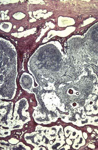 Lymph Node Architecture Capsule: DICT (collagen I is red/brown in silver stain) with trabeculae that extend into stroma of node (collagen III is black/brown) Subcapular space with macrophages