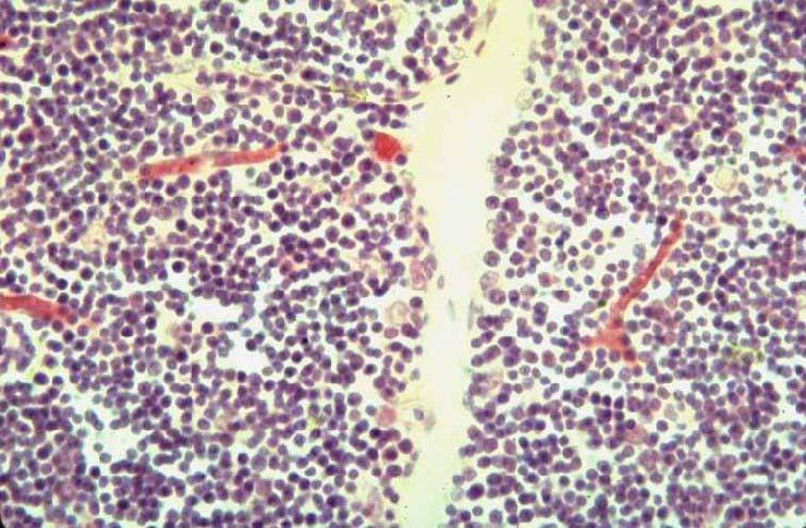 Thymus has 3 cell types Epithelioreticular cells are large, pale, and stellate (they are not reticular fibers!