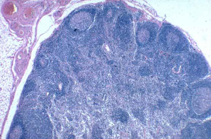 The Follicle Primary - Lymphocytes Secondary - Germinal