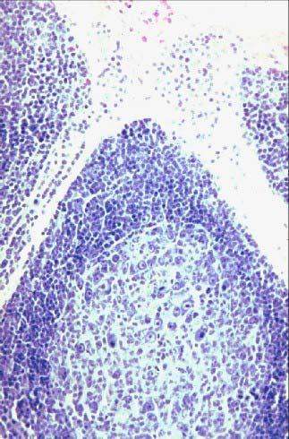 Secondary Follicle Germinal Center Pale staining center: Plasmablasts = B cells Large,