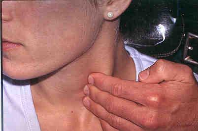 Internal jugular chain Examine the upper, middle and