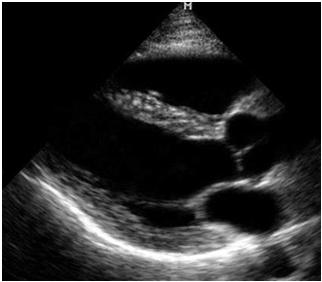 wave to return to the transducer Point-of-Care Ultrasound Examinations These are short focused exams to answer a specific clinical question at the bedside: is there a gallstone, is
