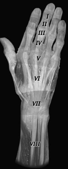 I -DIP joint II - middle phalanx III -PIP joint IV - proximal phalanx V -MCP joint VI - dorsum of hand VII -wrist extensor compartment VIII - extrinsic extensor muscles