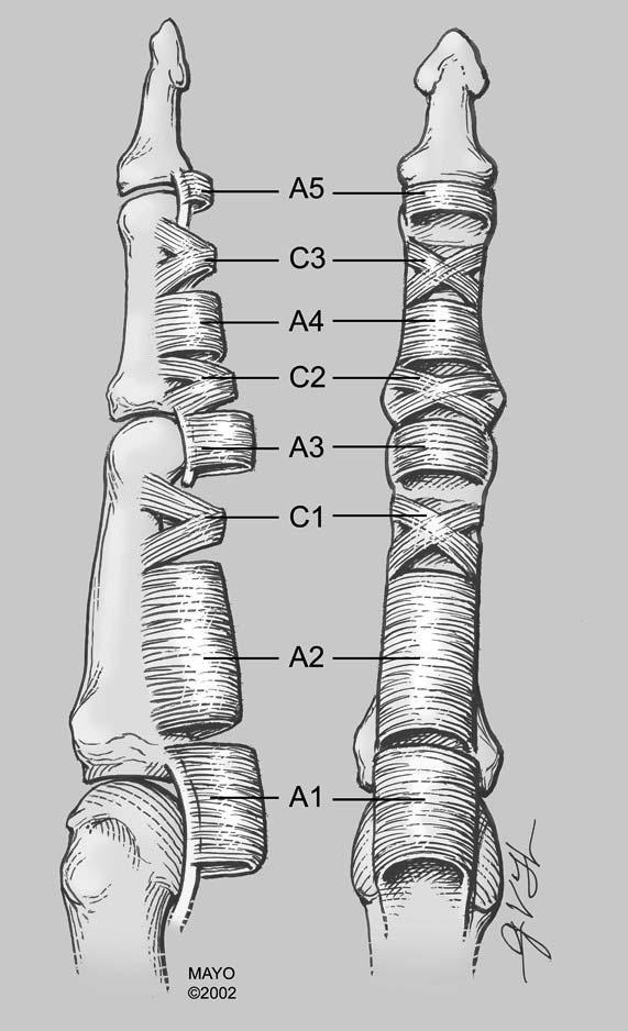 Flexor Pulley System Injury Flexor pulley system is divided into: 5
