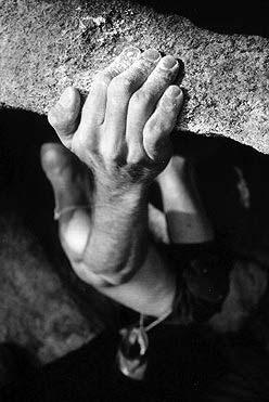 Flexor Pulley System Injury Injuries are seen in rock climbers and in other sports resulting in forced extension of a flexed finger Account for