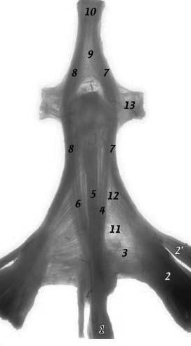 retinacular ligament oblique fibers transverse fibers interosseous muscle sagittal band Clavero JA et