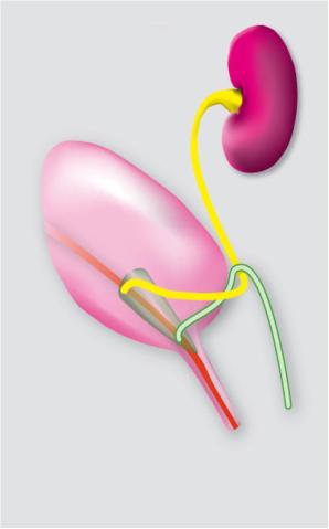 urogenital sinusureter bladder common nephric duct