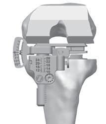 Place Persona Posterior Referencing 4-in-1 Cut Guide on the bone. Double check position of the cut guide with the 4-in-1 Adapter. 3.2mm Drill Hole Fig. 53 Fig.