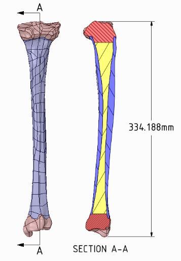 In this study there were totally fourteen different FE models to evaluate for the effective FE models to use for analyzing stresses in tibia bones during stance phrase running as shown in Table 1.