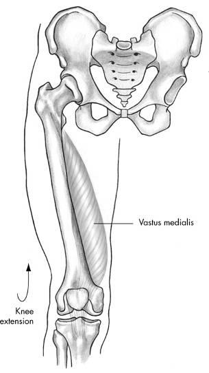 10-38 Vastus Medialis Muscle Hamstring Extension of Hamstring muscle group Semitendinosus Biceps femoris Semimembranosus 2007