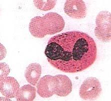 The most numerous immune white cells in the blood stream are the neutrophils also called (PMN).