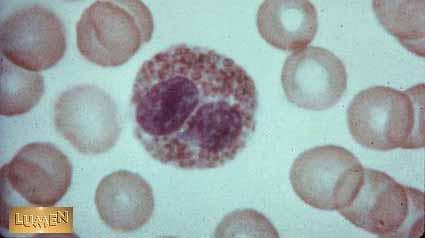 Eosinophil Eosinophils are granulocytes that stain intensely with 'eosin'.