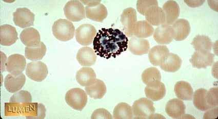 Basophil Basophils are found in low numbers in the blood.