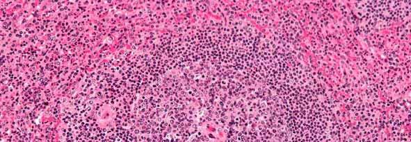 WHITE PULP The white pulp contains the lymphoid tissue, arranged around a central