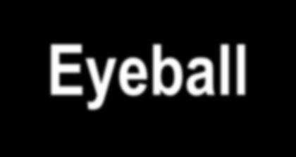 Eyeball Ethmoid sinus