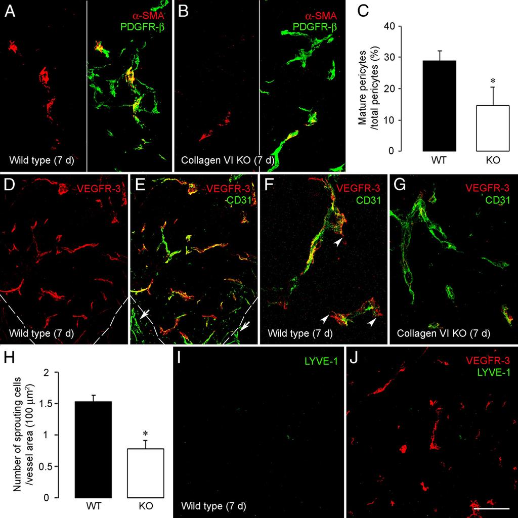 Collagen VI-Null Mouse Vessel Deficits 1151 Figure 3. Pericyte maturation and endothelial cell sprouting are reduced by collagen VI ablation.