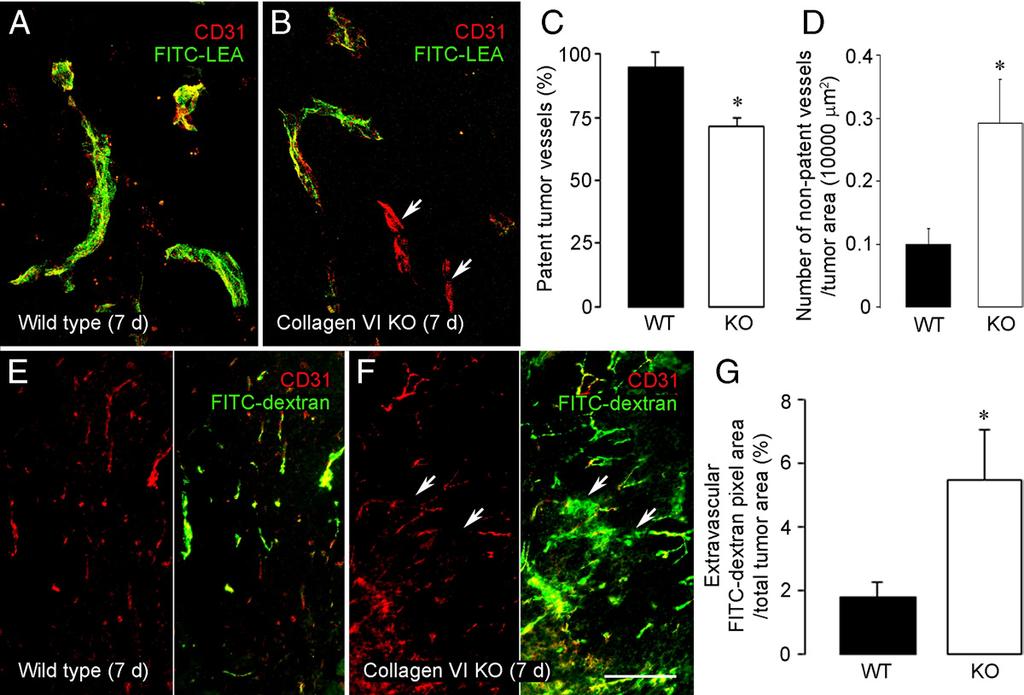 Collagen VI-Null Mouse Vessel Deficits 1153 Figure 5. Reduced vessel patency and increased vessel leakage in collagen VI-null tumors.