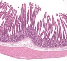 Lumen Mucosa Villi Submucosa Muscularis (Muscle