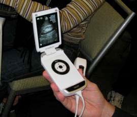 (Ob/Gyn, vascular) General purpose ultrasound units come in a variety of shapes and sizes.