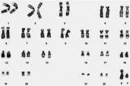 What is PCSK9? Chromosome: 1p32.