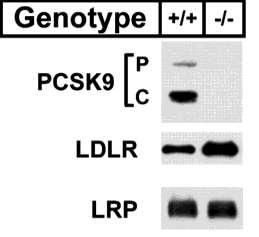 Immunofluorescence against LDL-R PCSK9 decreases