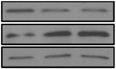 (f) Quantification of the percent of -silenced BT25 and BT48 cells positive for X-Gal staining compared with non-silenced cells