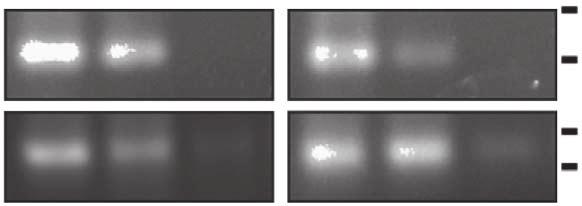 38,39; Fig. 3g). Chromatin immunoprecipitation (ChIP) experiments demonstrated further that endogenous localized to the promoters of p21 Cip1, b-galactosidase and GADD45A in BTICs (Fig.