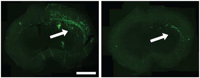 encoding GFP together with either non-silencing or 1. (a) First column shows dorsal view of a pair of representative brains.