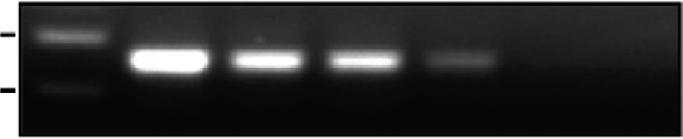(b) Double-labelling immunofluorescence analysis of TLE and in GBM or cultured BT12 cells. Nuclei were counterstained with.
