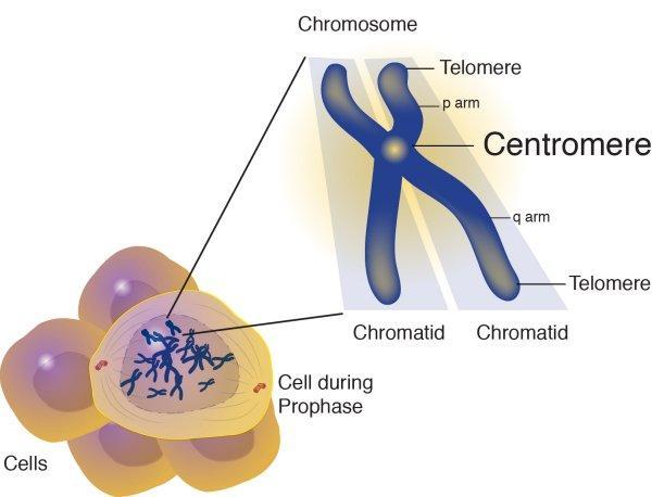 Įvadas į citogenetiką 1p/19q codelecija delecija 1 os chromsomos trumpajame (p) petyje + delecija 19 os chromosomos ilgajame petyje (q) +7 trisomija 7 os chromosomos