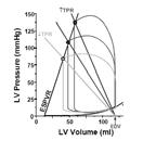 stiffness = 1/compliance 20 40 60 80 0 120 140 LV Volume (ml) LV Pressure (mmhg) 50 Diastolic