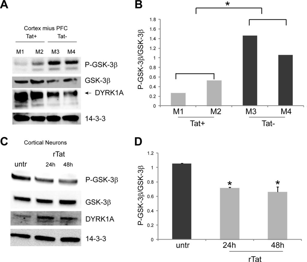 FIGURE 8. Tat mediates up-regulation of DYRK1A and activation of GSK-3 in vivo and in cell culture.